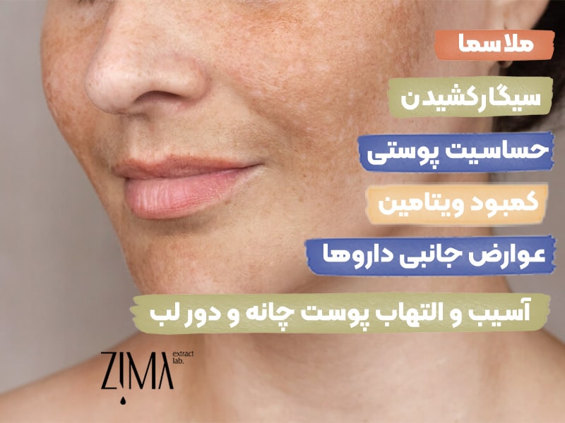 عوامل تیرگی چانه