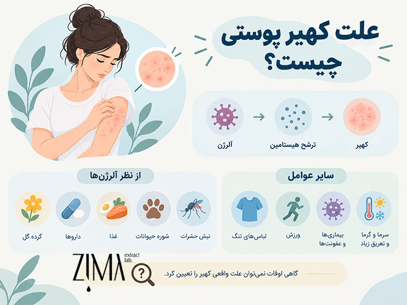 علت کهیر پوستی