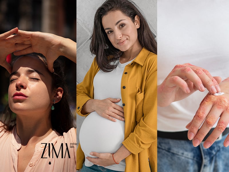 چه کسانی بیشتر لکه سیاه دارند